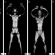 Illustration for article titled The Basic Things You Need To Know About Full-Body Scanners